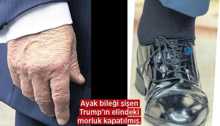 Epstein depremi