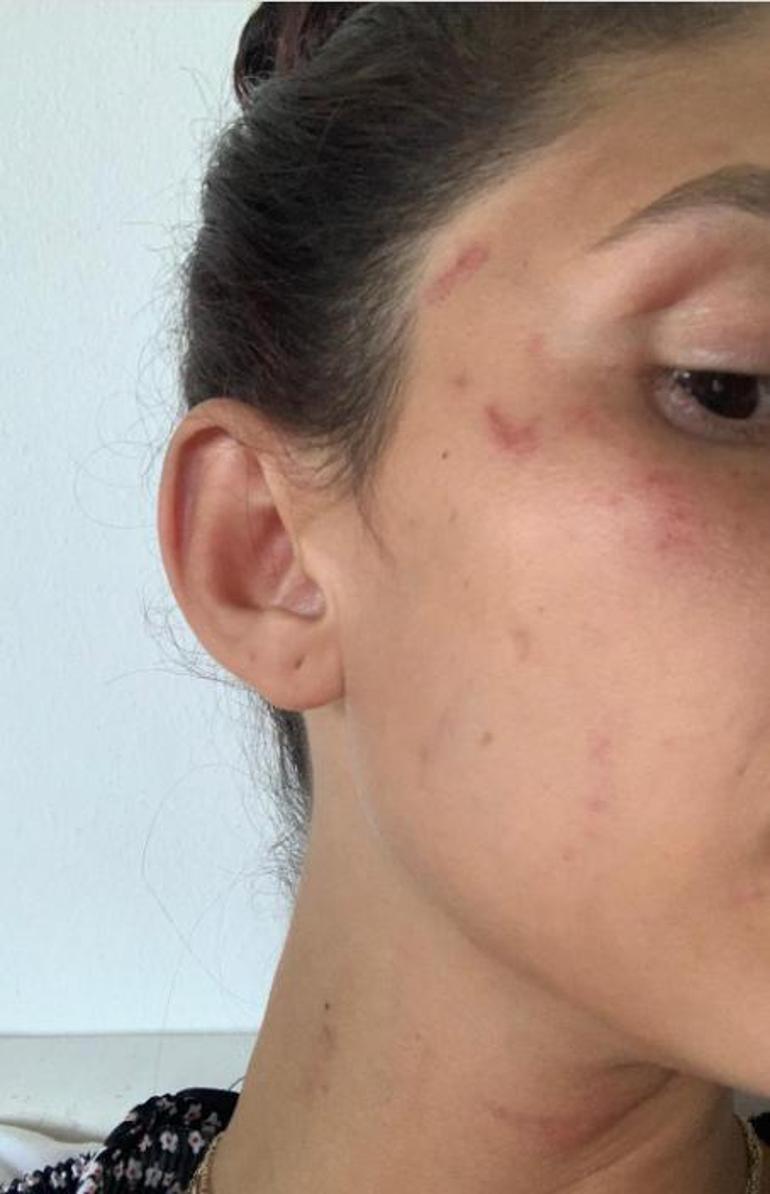 Can Yamanın sevgilisi Sara Bluma gerçekleri anlattı Her şeyi avukatlarıma bıraktım