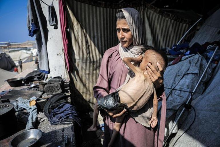 Sözün bittiği nokta Gazze açlıktan ölüyor