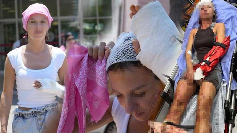 Uzaklaştırma kararı sonrası vahşet Kafatasına zımba atıldı, elleri kırıldı: Plan yapıp beni öldürmeye geldi