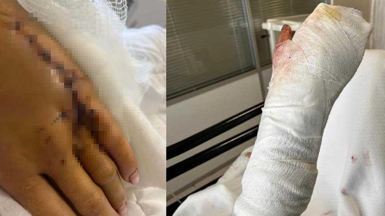 Uzaklaştırma kararı sonrası vahşet Kafatasına zımba atıldı, elleri kırıldı: Plan yapıp beni öldürmeye geldi