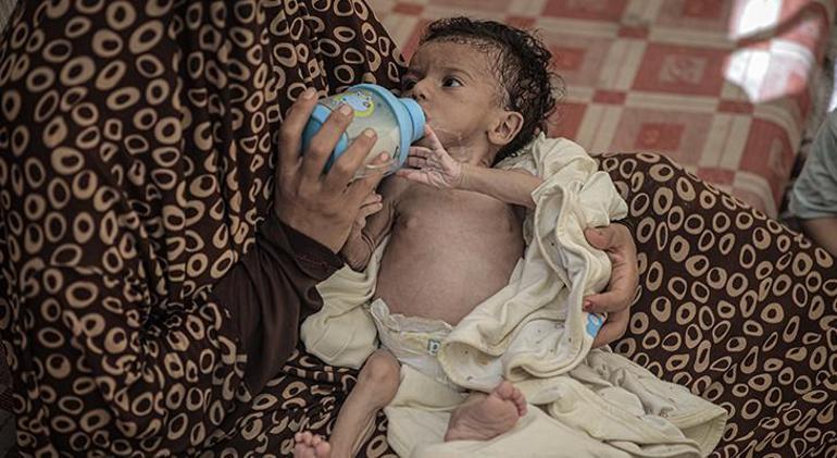 Gazzede anneler sütten kesildi, bebekler ölümün eşiğinde: Ne mama var ne temiz su