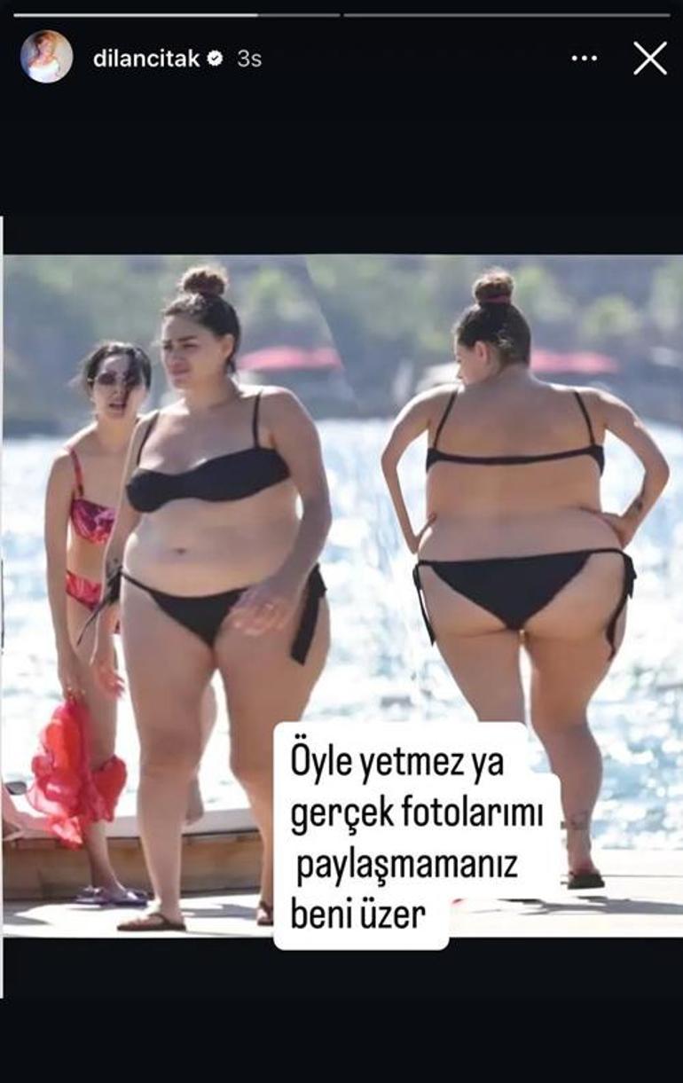 Olaylı Dilan Çıtak bu kez fotoğraflarına sinirlendi Öyle yetmez...